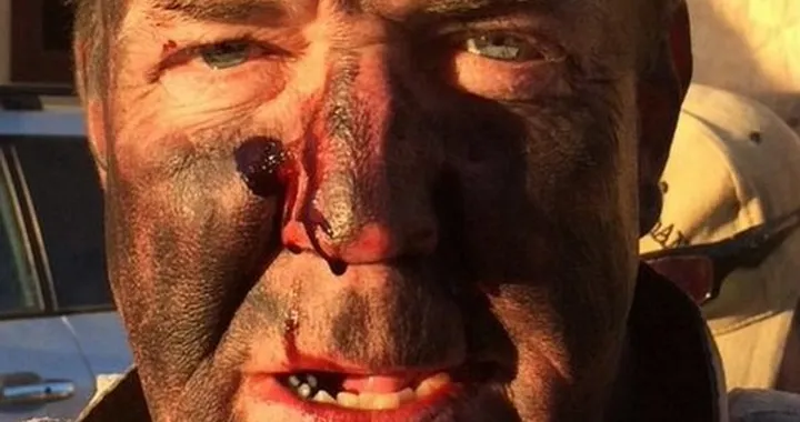 Incidente per Jeremy Clarkson durante le riprese dell'Amazon Prime Car Show