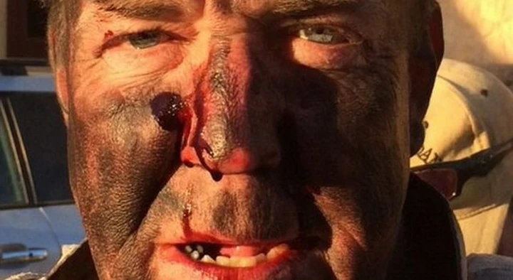 Incidente per Jeremy Clarkson durante le riprese dell'Amazon Prime Car Show